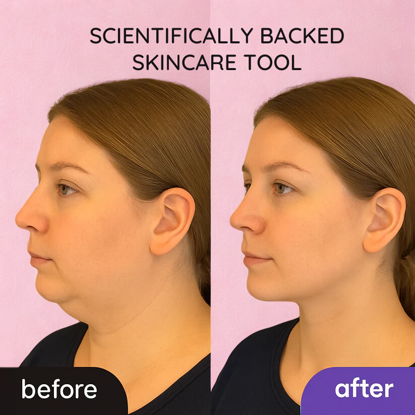 FaceLift Massaging Beauty Roller
